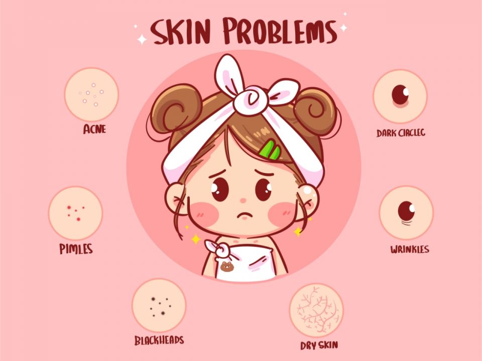 skin problems